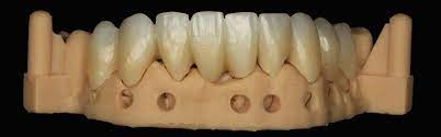 Inleiding tot Zirconia Ceramics